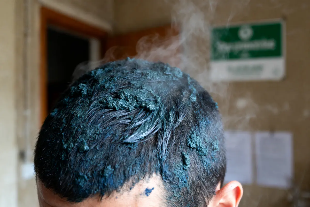 Maux de tête après coloration végétale : Causes, solutions et Pourquoi ?